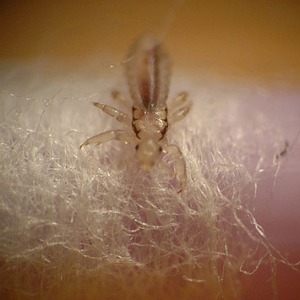 Can Bed Bugs Live In Your Hair Explained with Examples