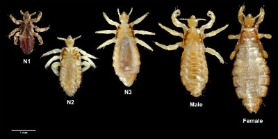 body lice pictures