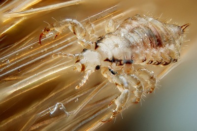 head louse in hair