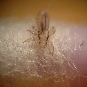 close up picture of louse