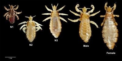 body lice pictures