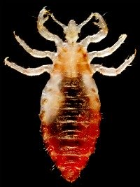 close up picture of head louse